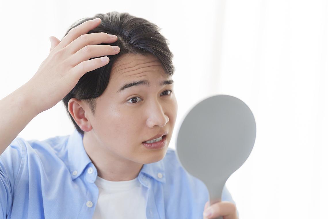 自毛植毛の注意点