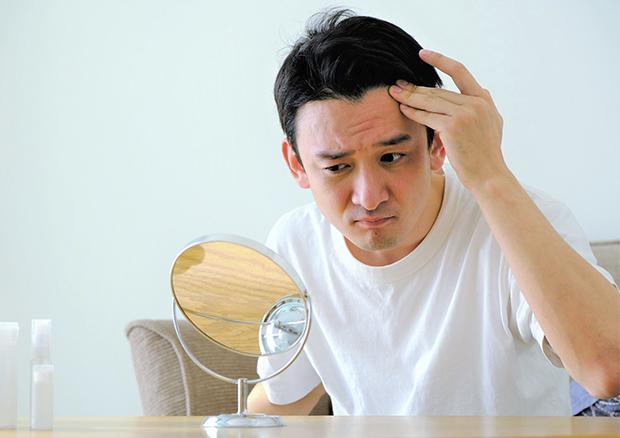 AGAは自然に治る?途中で止まる?