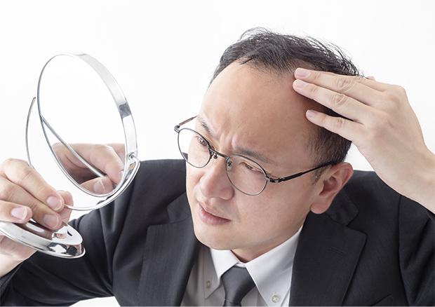 AGAの特徴は?