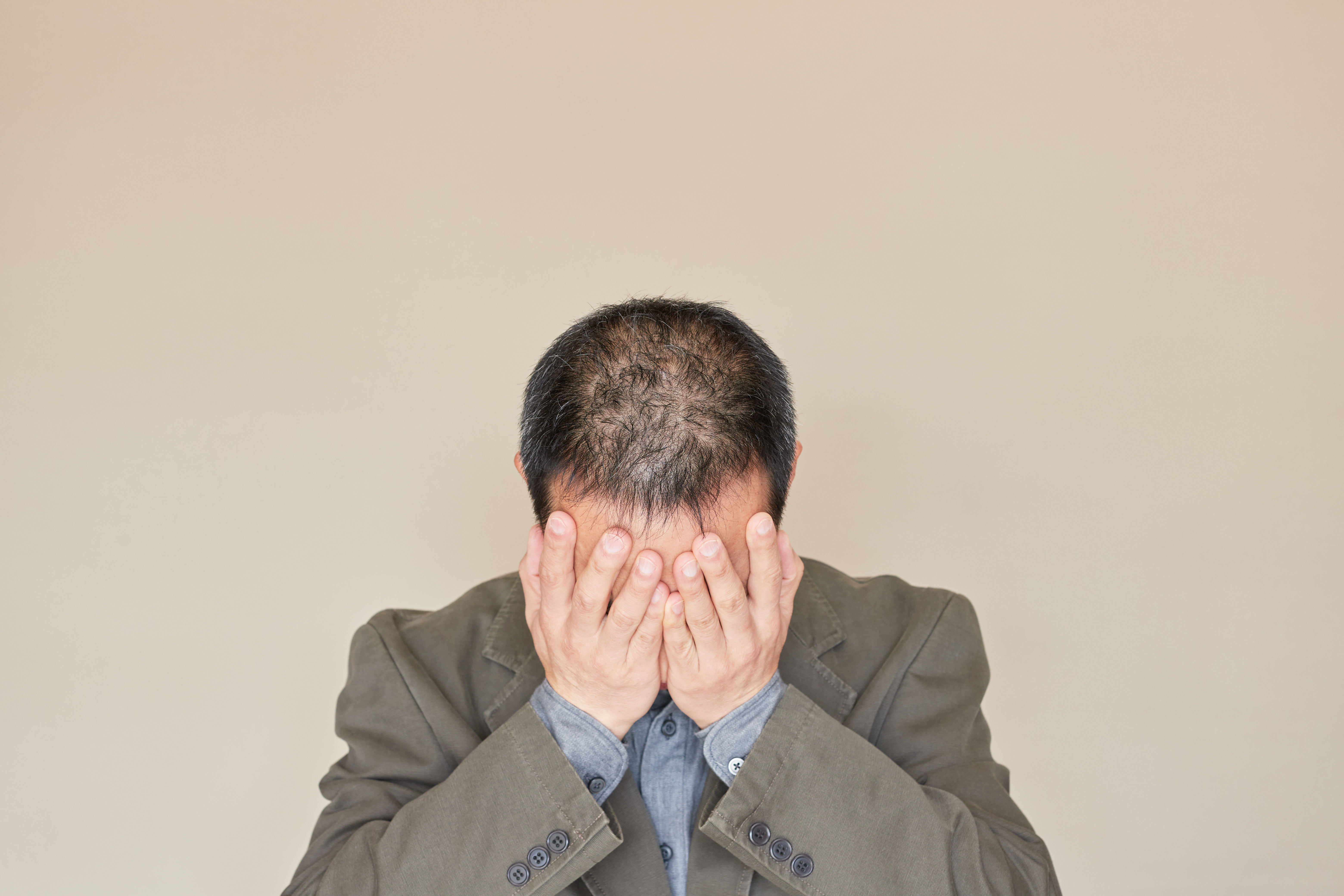 脱毛に悩む中年男性