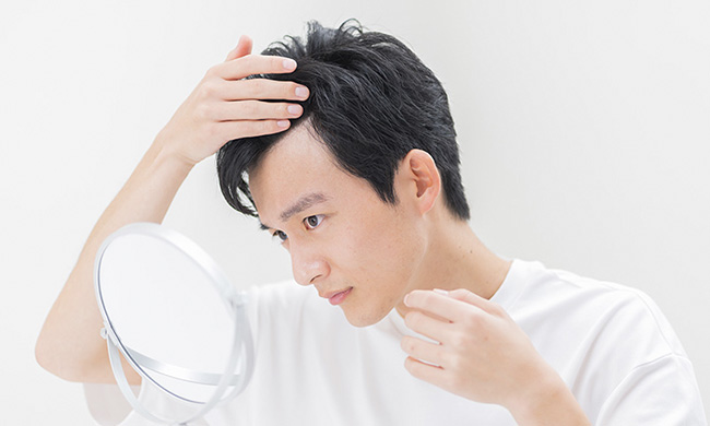 20代でも若ハゲに?その原因とは