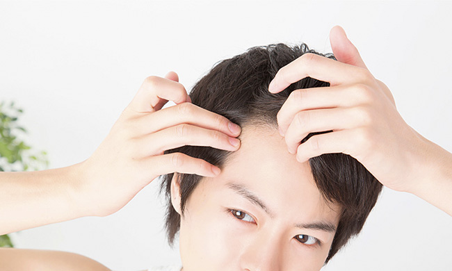 おでこを気にする若い男性