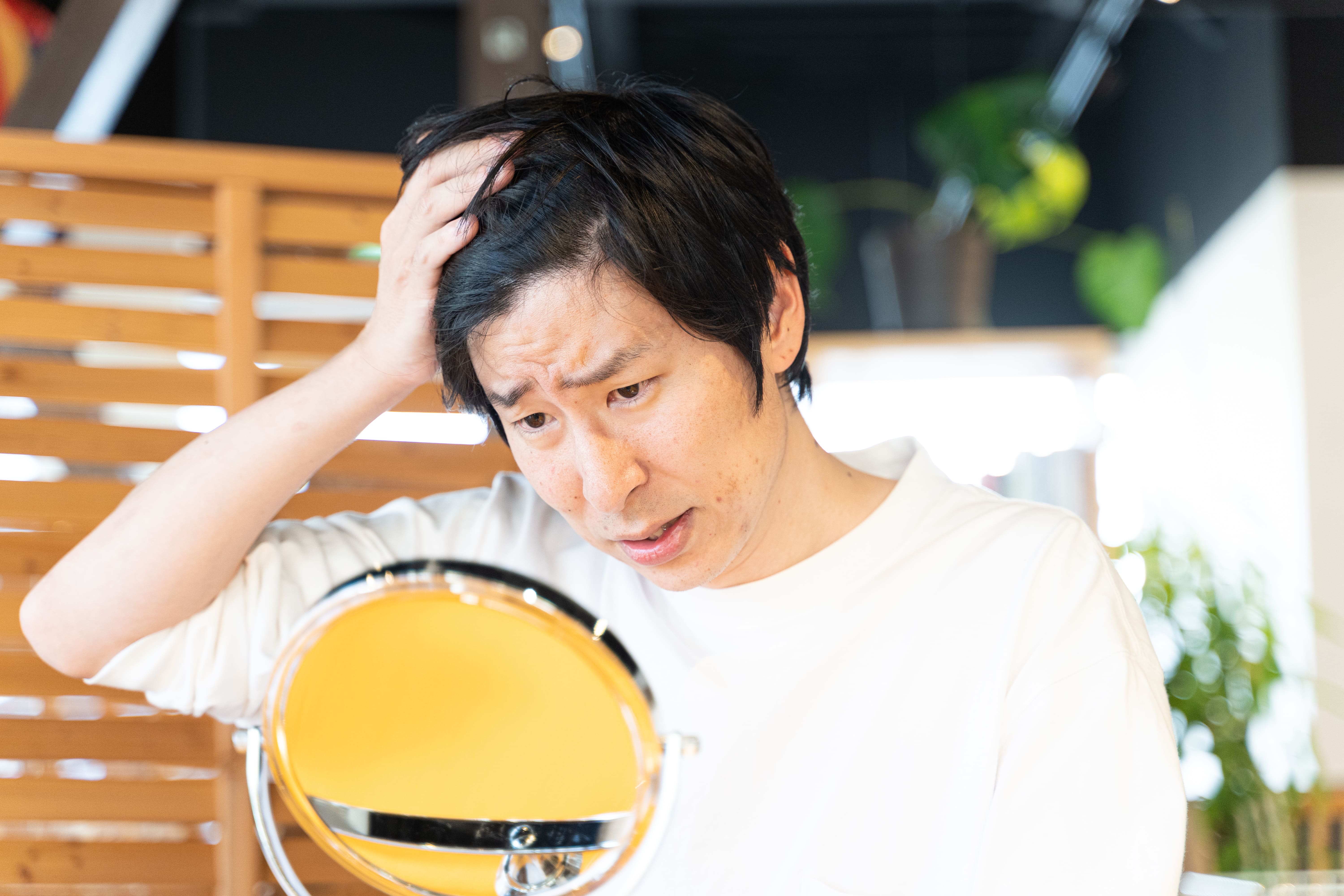 鏡を見ながら頭頂部の薄毛を気にする男性