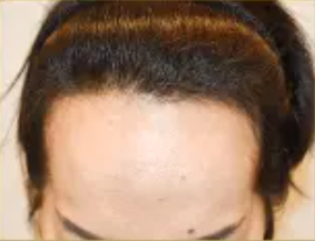 50代 女性 M.Mさん before