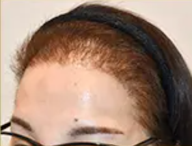 50代 女性 M.Mさん before
