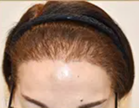 50代 女性 M.Mさん before