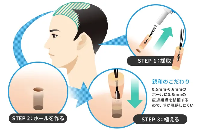 MIRAI法