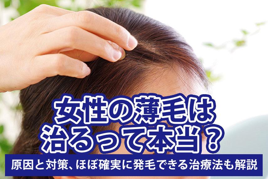 女性の薄毛は治るって本当？原因と対策、ほぼ確実に発毛できる治療法も解説