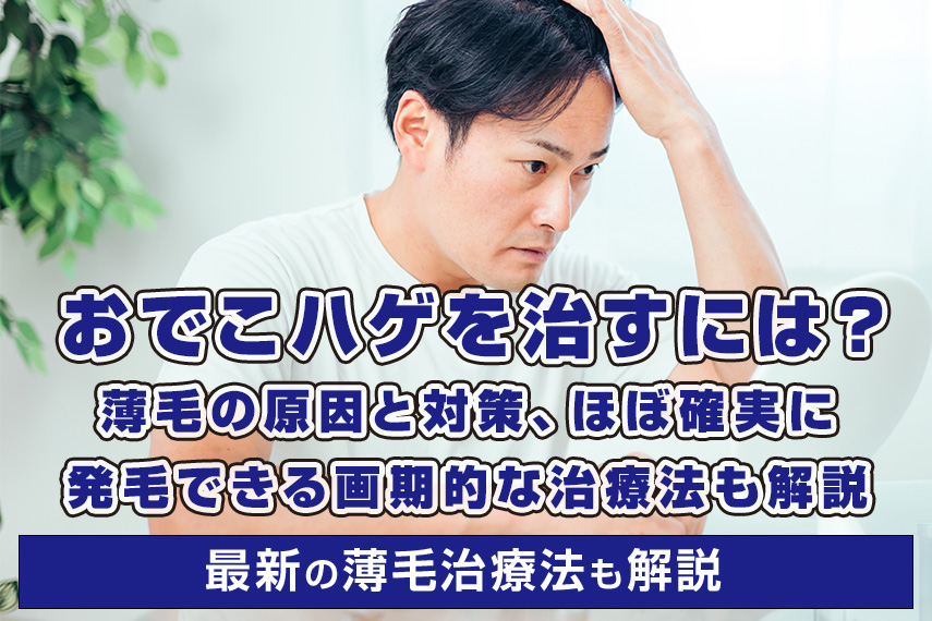 おでこハゲを治すには？薄毛の原因と対策、ほぼ確実に発毛できる画期的な治療法も解説