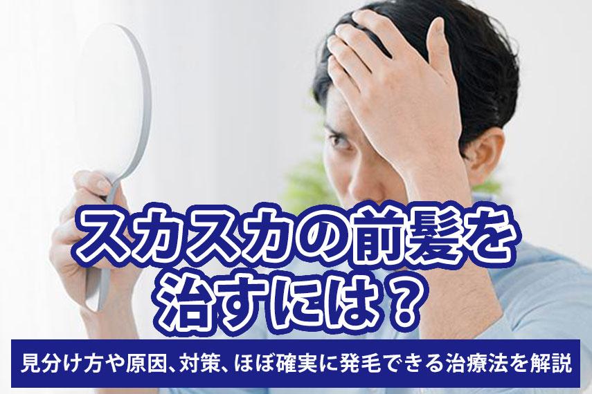 スカスカの前髪を治すには？見分け方や原因、対策、ほぼ確実に発毛できる治療法を解説