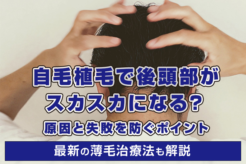 自毛植毛で後頭部がスカスカになる？原因や術後経過、失敗を防ぐポイントを解説