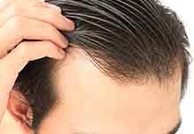 危険 毎日同じヘアスタイル が薄毛を引き起こす 親和クリニック