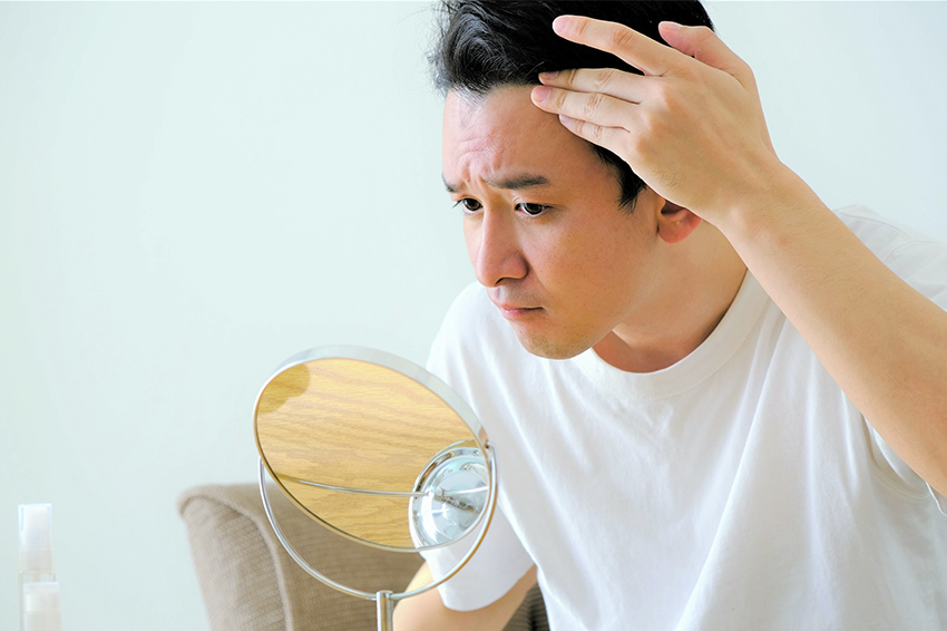 男性の前髪の薄毛の見分け方