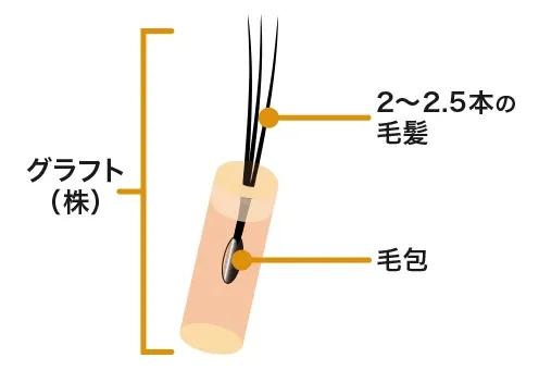 グラフト