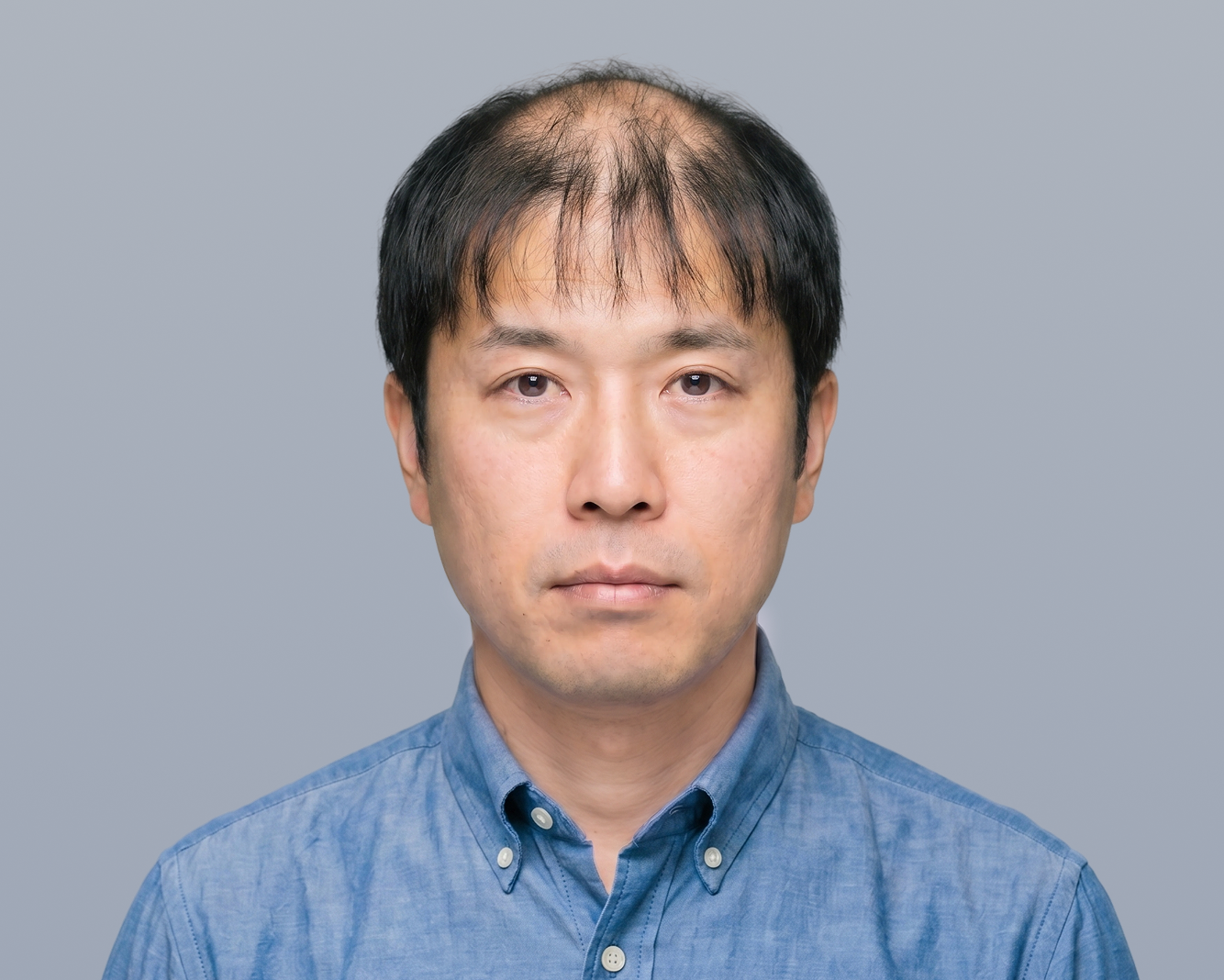 顔全体 Before（施術前）