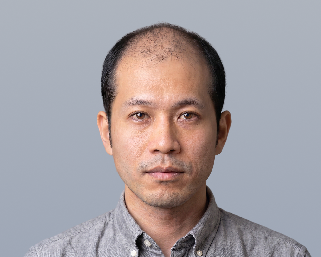 顔全体 Before（施術前）