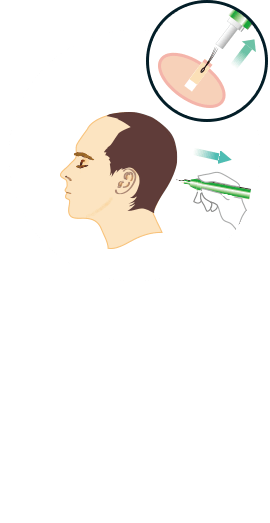 step1