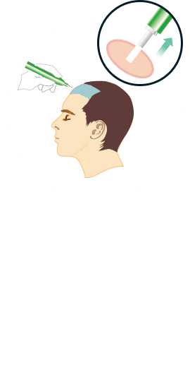 step2