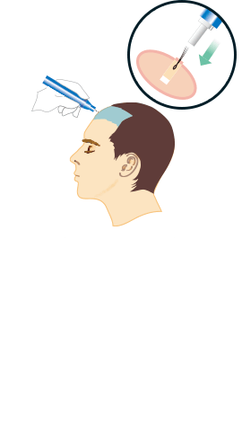 step3