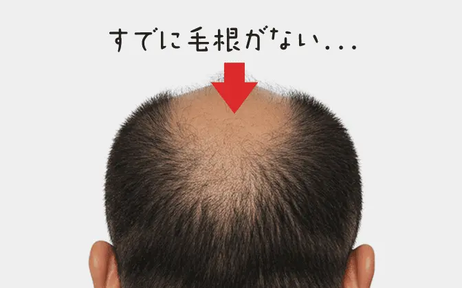 すでに毛がない…