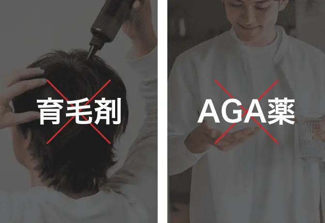 育毛剤× AGA薬×