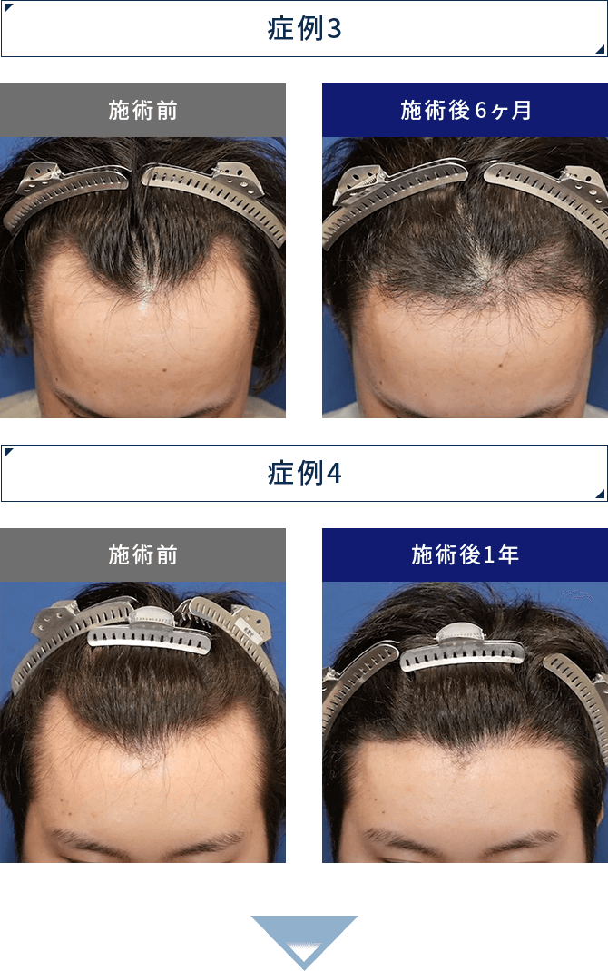 症例3, 症例4
