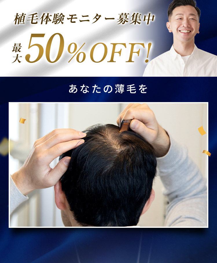 植毛体験モニター募集中 最大50%OFF！ あなたの薄毛を