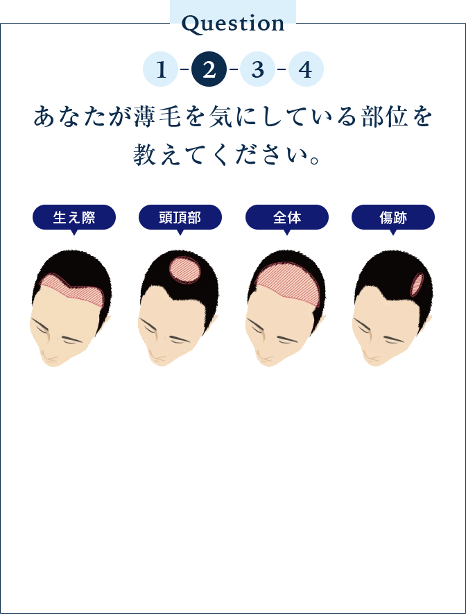 あなたが薄毛を気にしている部位を 教えてください。